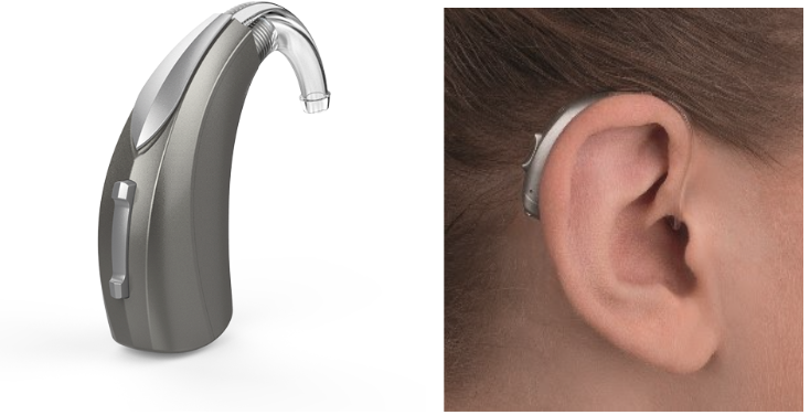Posso usar aparelho auditivo com perda leve? 
